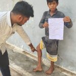 बरही में ‘आतंकी’ कुत्ते का खौफ: 13 वर्षीय बालक पर हमला, कई लोगों को काटने के आरोप; जिम्मेदारों की चुप्पी पर उठे बड़े सवाल